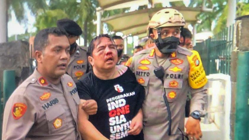 Mata Lebam Hidung Berdarah, Ade Armando Dikeroyok Massa Aksi 11 April 2022
